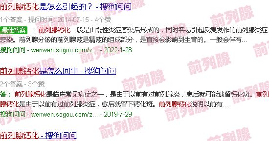 汕头前列腺钙化