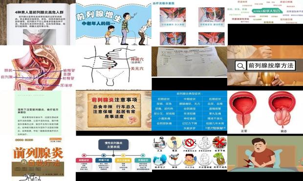 汕头前列腺炎症状自我疗法
