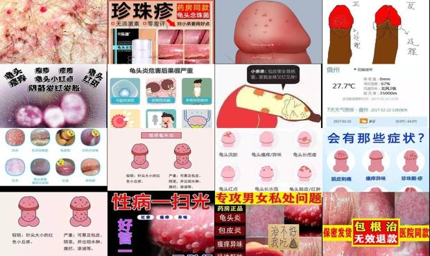 汕头鬼头炎症图片