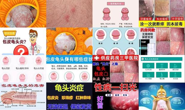 汕头男性龟头炎症状图片怎么样