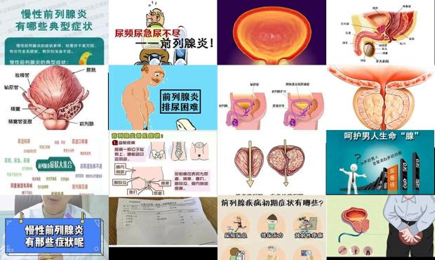 汕头慢性前列腺炎症状