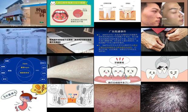 汕头男炎症的表现是什么