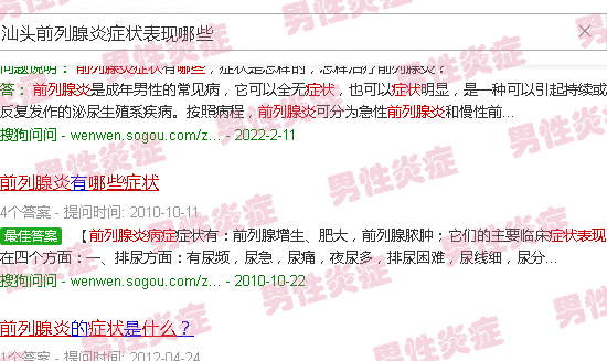 汕头前列腺炎症状表现哪些