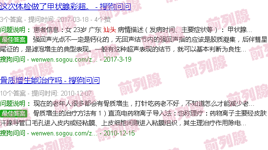 汕头前列腺钙化灶