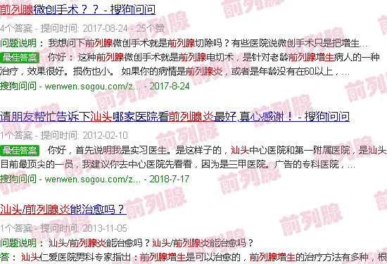 汕头前列腺肥大