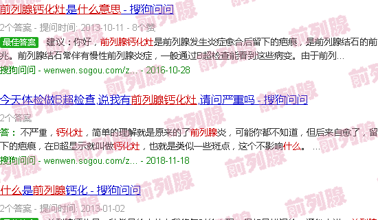 汕头前列腺钙化灶什么意思
