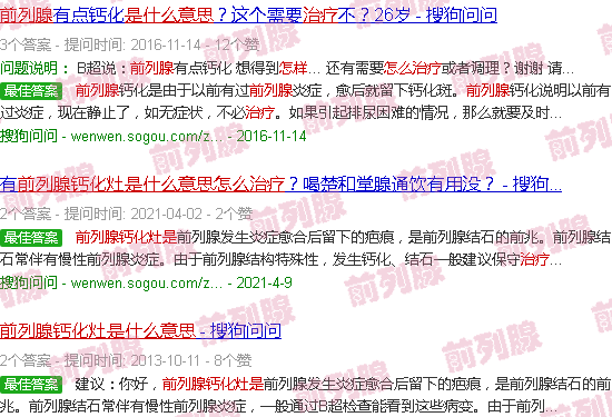 汕头前列腺钙化灶是什么意思,怎么治疗