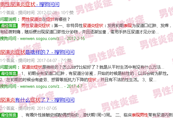 汕头尿道炎症状表现男