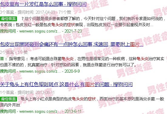 汕头龟头炎症状的图片大*