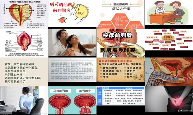 汕头前列腺影响性功能吗