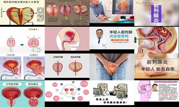 汕头年轻人前列腺会自愈吗