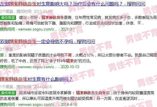 汕头精索静脉曲张不育
