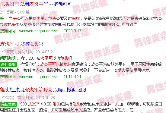 汕头皮炎平可以治疗龟头炎症吗
