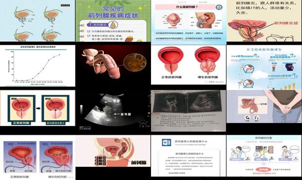 汕头前列腺增大是什么意思