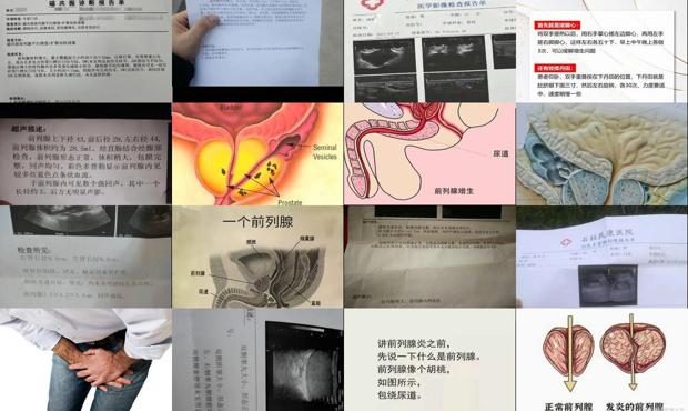 汕头前列腺稍大是什么意思