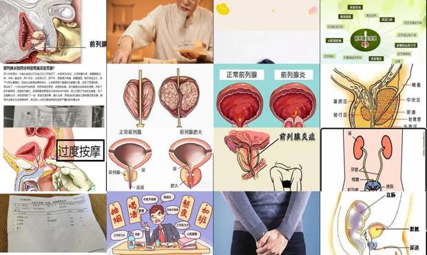 汕头前列腺炎如何