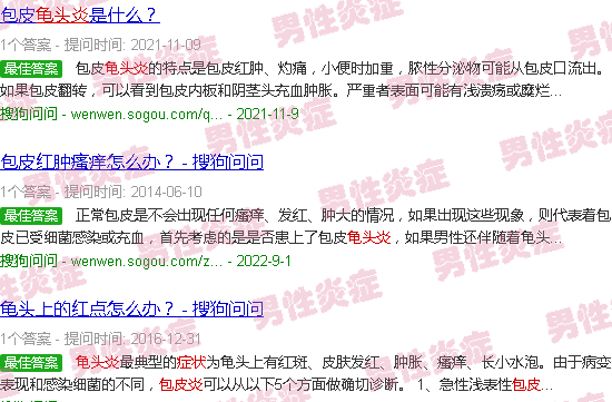 汕头包皮炎龟头炎症状