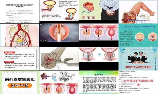 汕头前列腺增生的治疗方法
