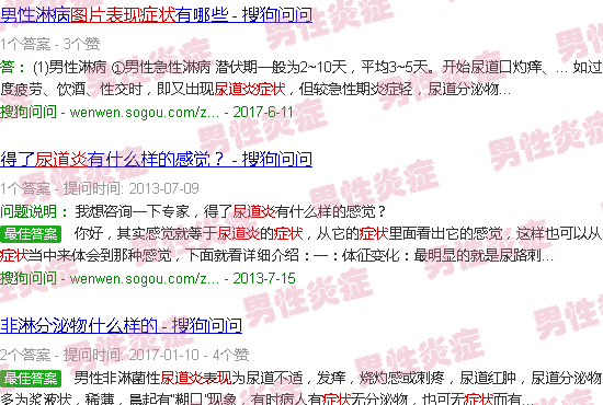 汕头尿道炎症状表现男图片