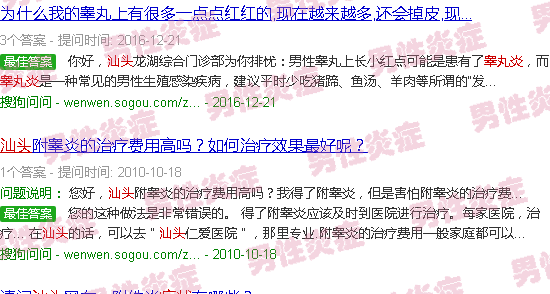 汕头睾丸炎症状的图片图库