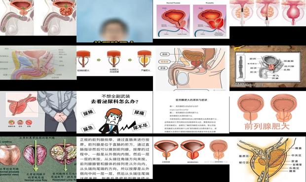 汕头前列腺肥大是怎么得的