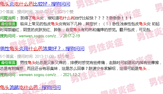 汕头龟头炎症吃什么药
