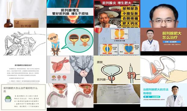 汕头前列腺肥大怎么治疗*好的方法