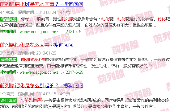汕头前列腺钙化是怎么回事