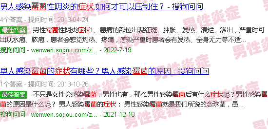 汕头霉菌龟头炎症状