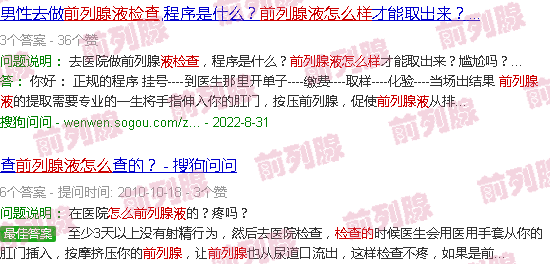 汕头前列腺液怎么检查的