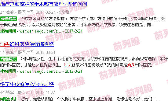 汕头前列腺治疗仪