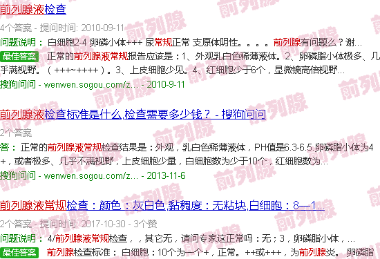汕头前列腺液常规