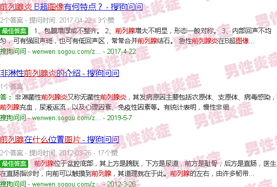 汕头什么是前列腺炎症图片