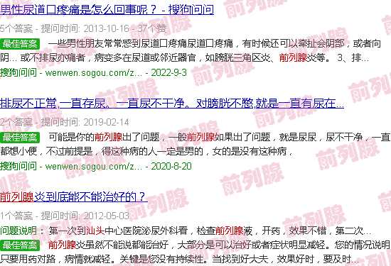 汕头前列腺痛