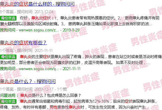 汕头男性睾丸炎症状