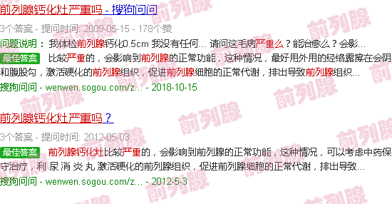 汕头前列腺钙化灶严重吗