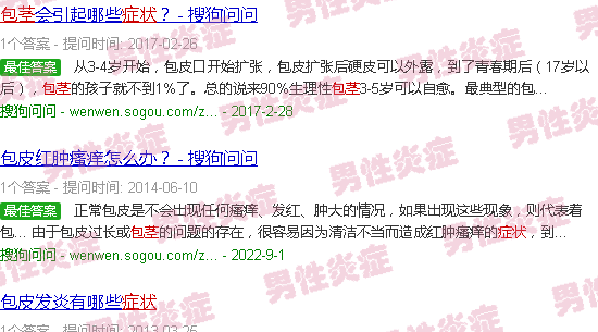 汕头包茎炎症状