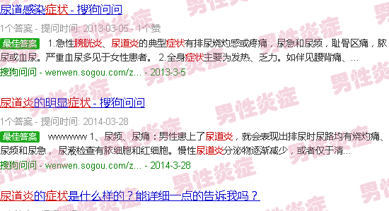汕头尿道炎膀胱炎症状图片