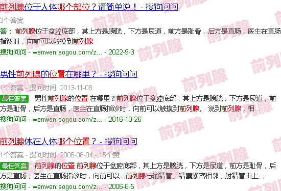 汕头前列腺在哪个部位