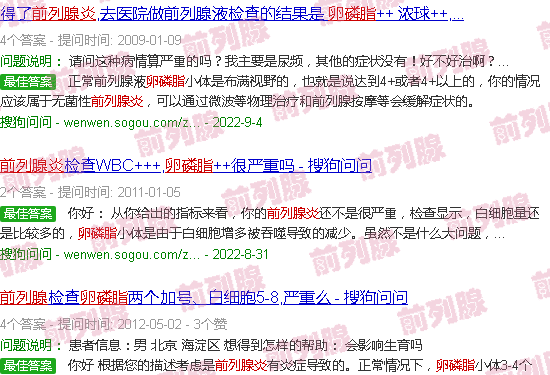 汕头前列腺炎卵磷脂