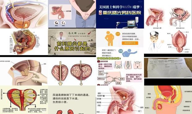 汕头前列腺炎是怎样造成的