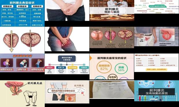汕头前列腺炎的证壮
