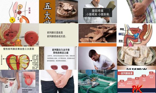 汕头前列腺小腹