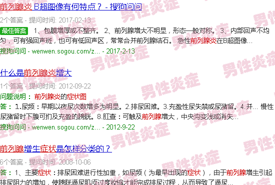 汕头前列腺炎症状图