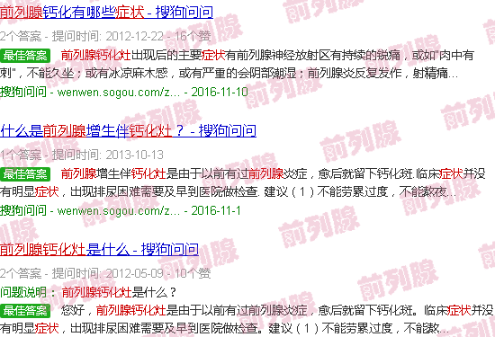 汕头前列腺钙化灶的症状