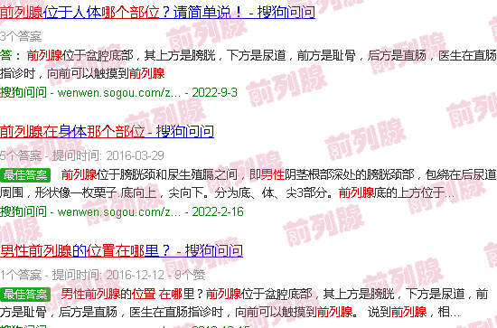 汕头前列腺在男人的那个部位