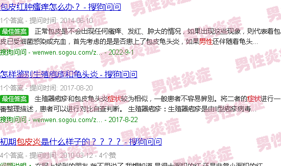 汕头男性包皮炎症状图片