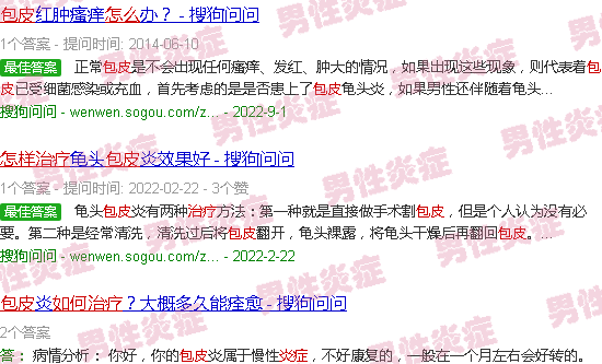 汕头包皮炎症怎么治疗