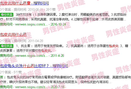 汕头包皮炎症状用什么药膏
