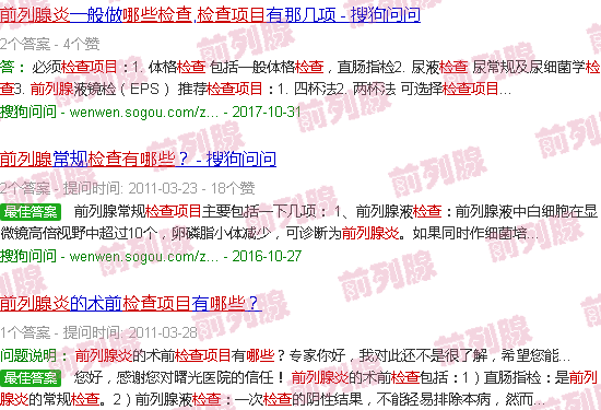 汕头前列腺炎检查什么项目